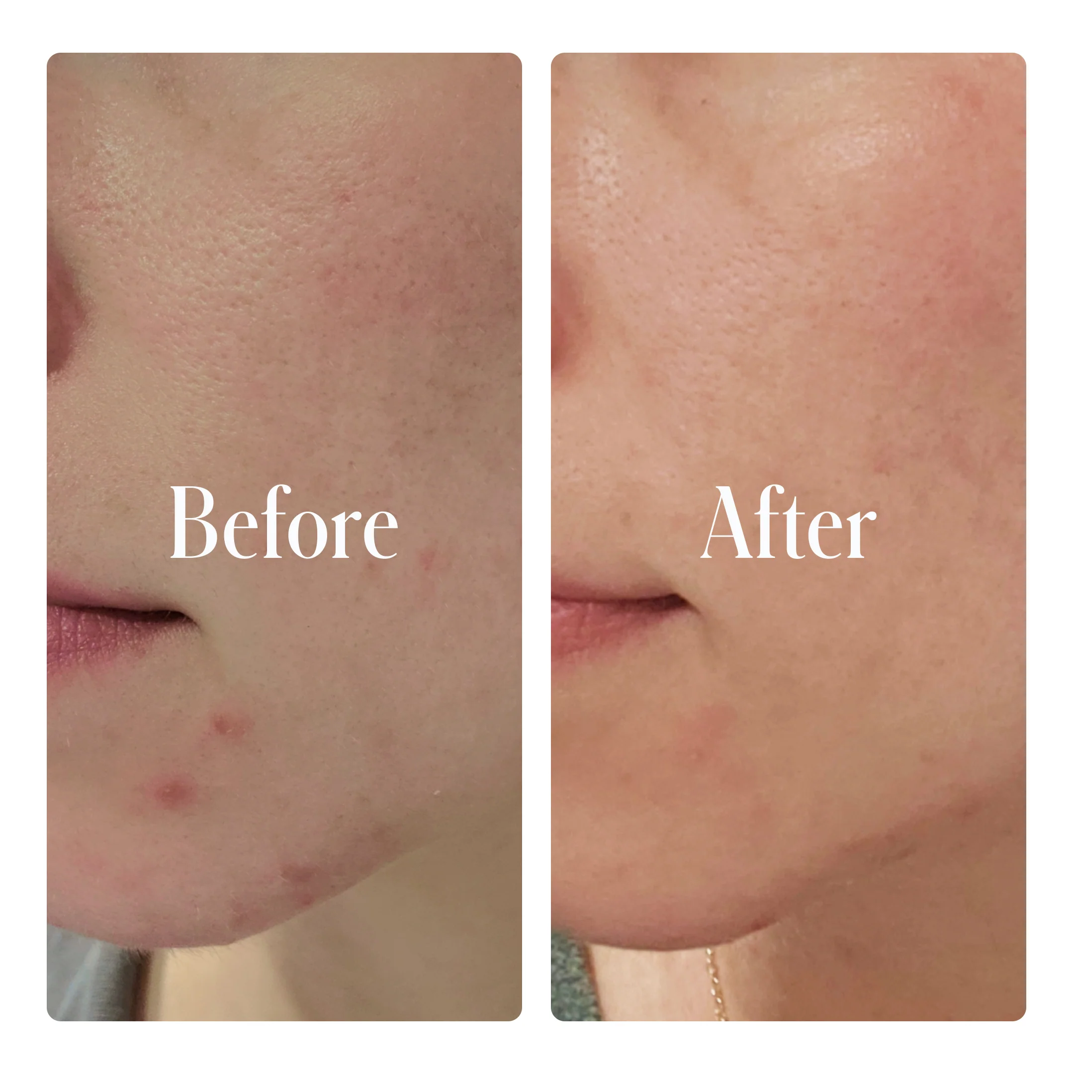 Clear System Face Routine - Image 4