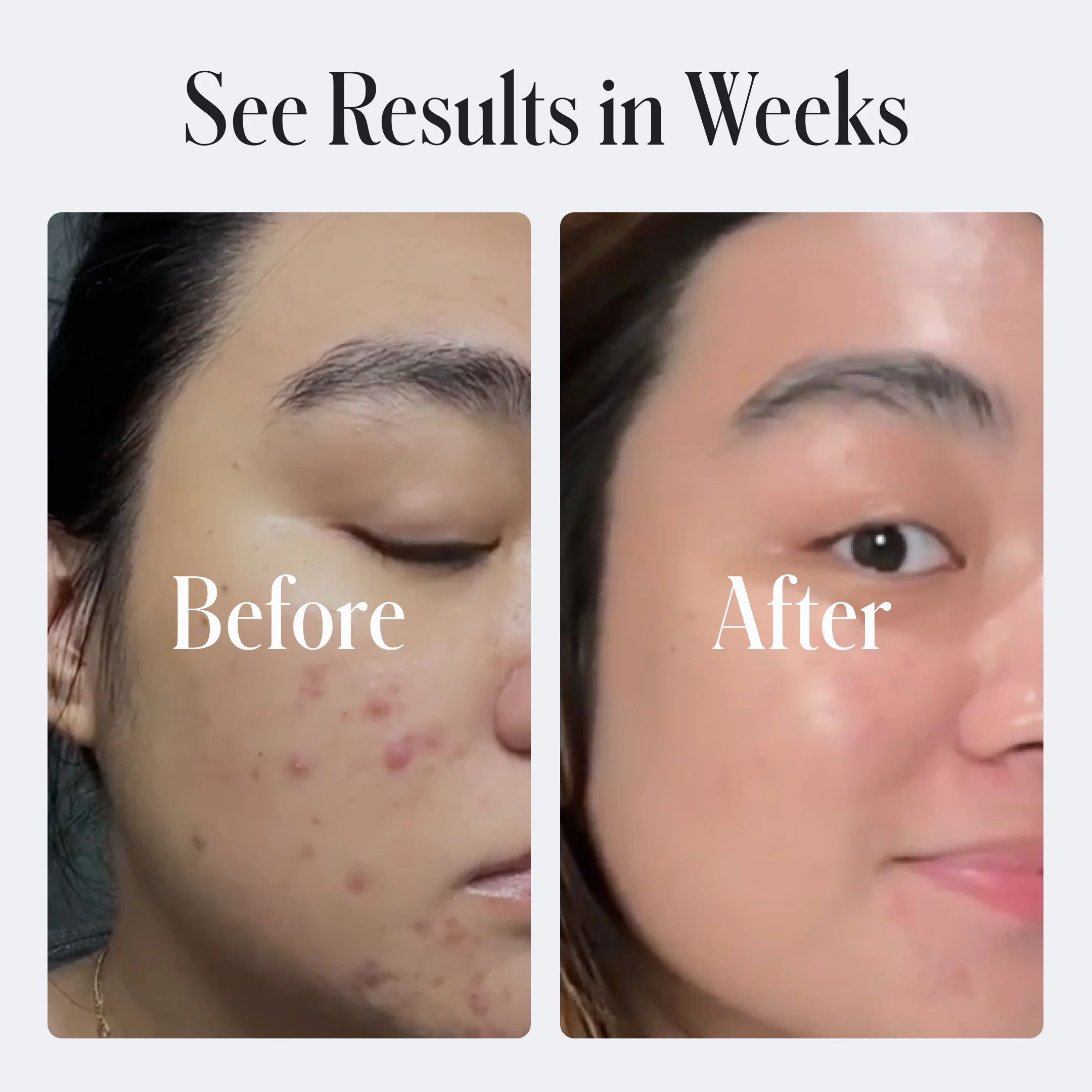 Clear System Starter Routine - Image 4