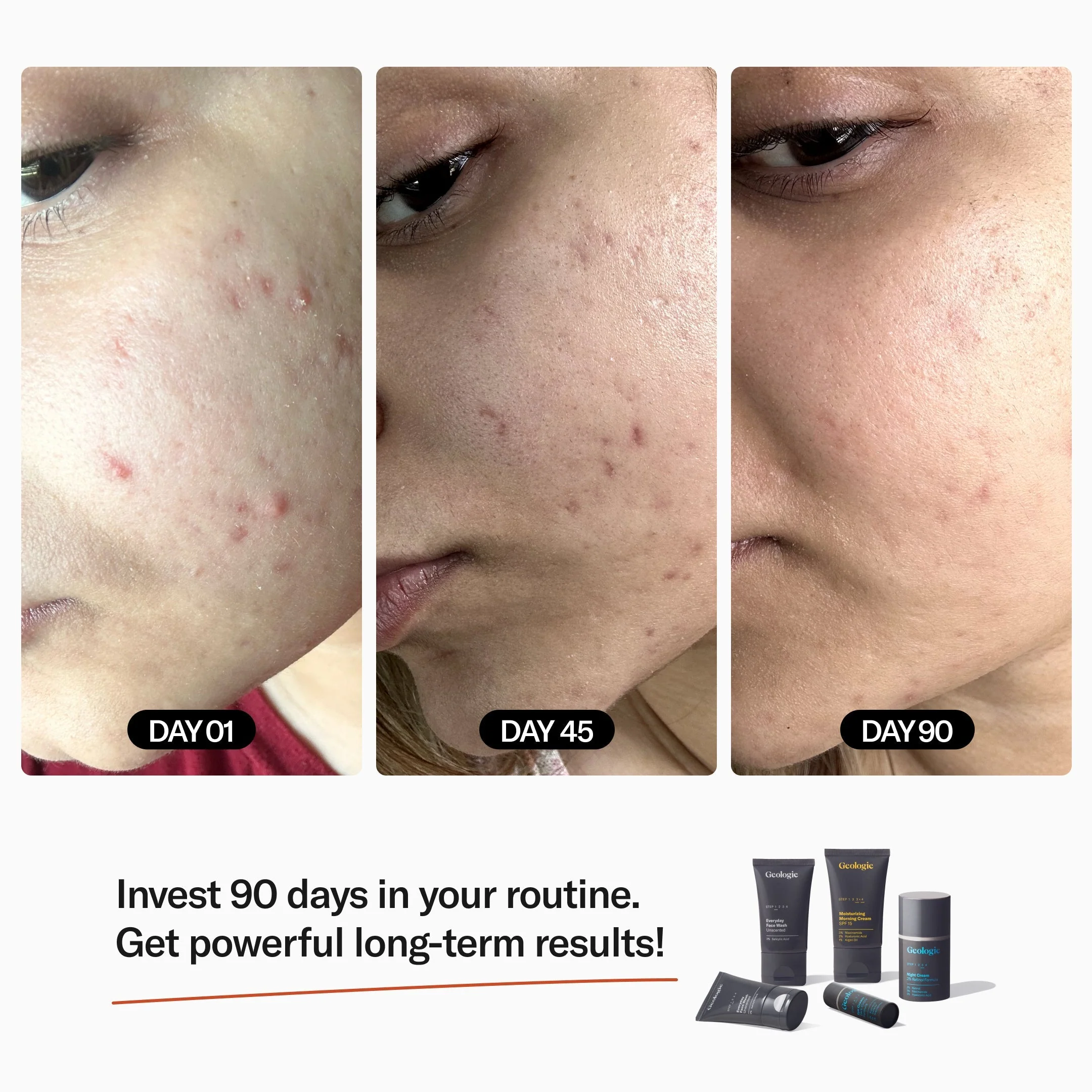 Complete Skincare Sample Set - Image 4