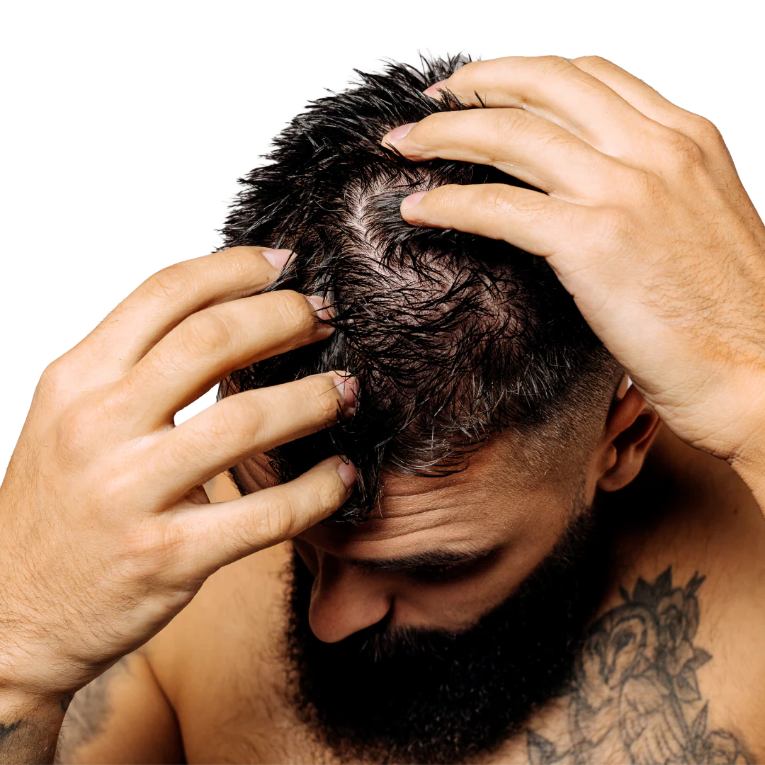 Dandruff Shampoo + Conditioner Bundle - Image 4