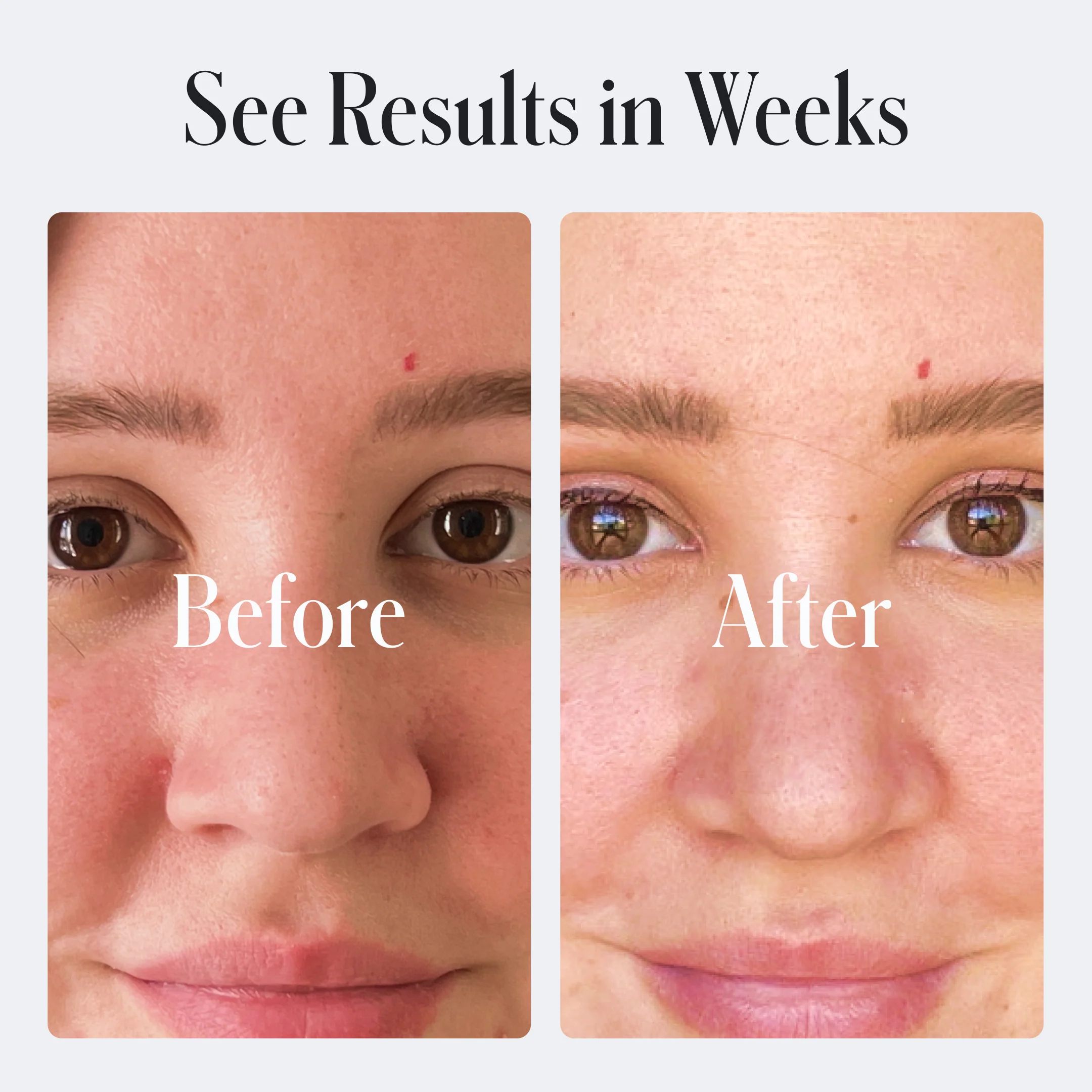 Skin Repair Moisturizer - Image 11